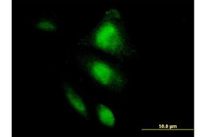 Immunofluorescence of monoclonal antibody to HSPA2 on HepG2 cell.