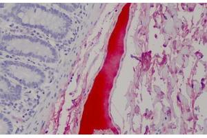 Human Blood Plasma: Formalin-Fixed, Paraffin-Embedded (FFPE) (Complement Factor H anticorps)