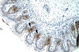 Image no. 1 for anti-Ets Variant 6 (ETV6) (AA 320-369) antibody (ABIN6735805)