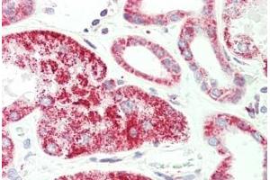 Human, Kidney: Formalin-Fixed Paraffin-Embedded (FFPE)