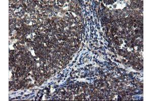 Image no. 3 for anti-CCR4-NOT Transcription Complex Subunit 4 (CNOT4) (AA 190-455) antibody (ABIN1491098) (CNOT4 anticorps  (AA 190-455))