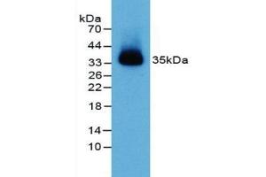 Detection of NECTIN2 in Mouse Heart Tissue using Polyclonal Antibody to Nectin 2 (NECTIN2) (PVRL2 anticorps  (AA 83-291))