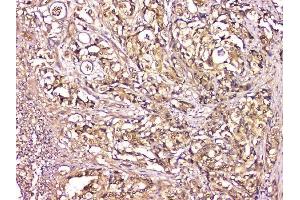 IHC analysis of CA2 using anti-CA2 antibody (ABIN6719533). (CA2 anticorps  (AA 2-260))