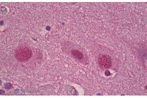 Anti-ROR Alpha antibody IHC staining of human brain, cortex. (RORA anticorps  (AA 6-55))