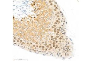 Immunohistochemistry of paraffin embedded rat testis using PRPF3 (ABIN7075311) at dilution of 1: 1100 (400x lens)