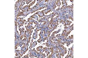 IHC analysis of TOMM34 using anti-TOMM34 antibody (ABIN7599253). (TOMM34 anticorps  (AA 1-309))
