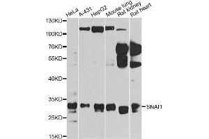 Western blot analysis of extracts of various cell lines, using SNAI1 antibody (ABIN5975364) at 1/1000 dilution. (SNAIL anticorps)