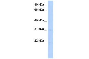 SLC25A21 antibody used at 1 ug/ml to detect target protein. (SLC25A21 anticorps)