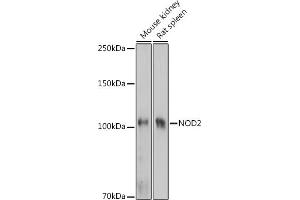Western blot analysis of extracts of various cell lines, using NOD2 Rabbit pAb (ABIN7269065) at 1:1000 dilution. (NOD2 anticorps  (AA 611-910))