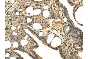Immunohistochemistry (IHC) image for anti-Transient Receptor Potential Cation Channel, Subfamily C, Member 4 Associated Protein (TRPC4AP) antibody (ABIN5957757) (TRPC4AP anticorps)