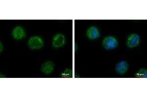 ICC/IF Image CHMP5 antibody [N1C3] detects CHMP5 protein at cytoplasm by immunofluorescent analysis. (CHMP5 anticorps)