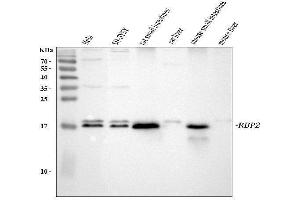 Western blot analysis of RBP2 using anti-RBP2 antibody (ABIN7599613).