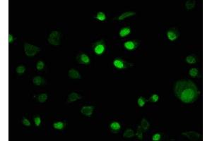 Immunofluorescence staining of MCF-7 cells with ABIN7157075 at 1:100, counter-stained with DAPI.