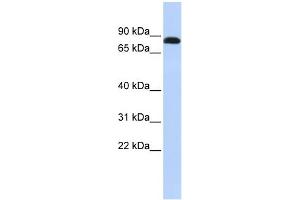 WB Suggested Anti-DSC3 Antibody Titration:  0. (Desmocollin 3 anticorps  (N-Term))