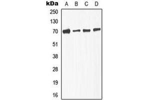 Western blot analysis of TGFBR2 (pS225) expression in A549 (A), NIH3T3L1 (B), KNRK (C), HepG2 (D) whole cell lysates.