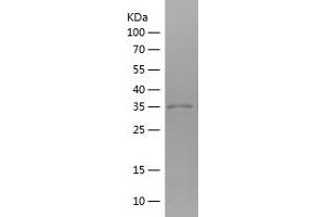 Western Blotting (WB) image for Glutaminase (GLS) (AA 609-669) protein (His-IF2DI Tag) (ABIN7123119)
