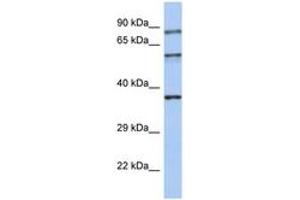 Image no. 1 for anti-Rabphilin 3A (RPH3A) (AA 35-84) antibody (ABIN6744373) (RPH3A anticorps  (AA 35-84))
