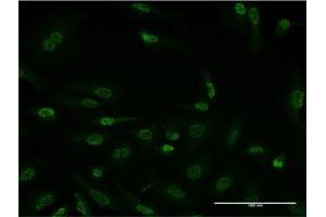 Immunofluorescence of monoclonal antibody to HDAC3 on HeLa cell.