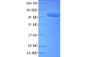 SDS-PAGE (SDS) image for Casein Kinase 2, beta (CSNK2B) (AA 2-215), (partial) protein (GST tag) (ABIN5712175)