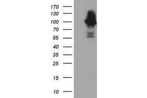 Western Blotting (WB) image for anti-Complement Component 1, S Subcomponent (C1S) antibody (ABIN1497565) (C1S anticorps)