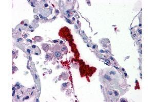 Immunohistochemistry (IHC) image for anti-Kallikrein 6 (KLK6) (N-Term) antibody (ABIN2778179)