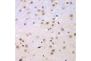 Immunohistochemistry of paraffin-embedded mouse brain using RNF2 antibody.