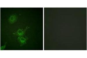 Immunofluorescence analysis of HuvEc cells, using EGFR (Phospho-Thr693) Antibody. (EGFR anticorps  (pThr693))