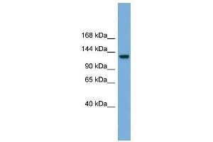 RASGRF1 antibody used at 0. (RASGRF1 anticorps  (Middle Region))