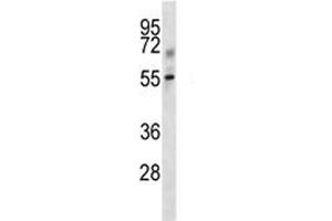 Tgfbr1 antibody western blot analysis in mouse kidney tissue lysate. (TGFBR1 anticorps  (AA 141-169))