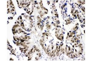 IHC analysis of KDM5B using anti-KDM5B antibody (ABIN4886648). (KDM5B anticorps  (Middle Region))