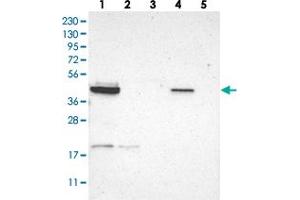 Western blot analysis of Lane 1: RT-4, Lane 2: U-251 MG, Lane 3: Human Plasma, Lane 4: Liver, Lane 5: Tonsil with GRAMD3 polyclonal antibody  at 1:250-1:500 dilution. (GRAMD3 anticorps)