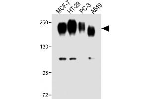 All lanes : Anti-CEA Antibody (Center) at 1:1000 dilution Lane 1: MCF-7 whole cell lysate Lane 2: HT-29 whole cell lysate Lane 3: PC-3 whole cell lysate Lane 4: A549 whole cell lysate Lysates/proteins at 20 μg per lane. (CEA anticorps  (AA 400-429))