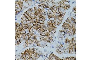 Immunohistochemistry of paraffin-embedded human stomach using CLDN3 antibody (ABIN3017039, ABIN3017040, ABIN3017041, ABIN1679261 and ABIN6219930) (40x lens). (Claudin 3 anticorps)