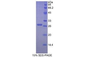 SDS-PAGE (SDS) image for Ectodysplasin A (EDA) (AA 141-378) protein (His tag,GST tag) (ABIN2120978) (Ectodysplasin A Protein (EDA) (AA 141-378) (His tag,GST tag))