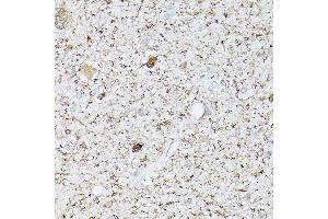 Immunohistochemistry of paraffin-embedded human brain using PGP9.