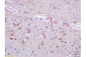 Formalin-fixed and paraffin embedded rat brain labeled with Anti-ASN/Fatty Acid Synthase 1 Polyclonal Antibody, Unconjugated (ABIN687382) at 1:200, followed by conjugation to the secondary antibody and DAB staining (Fatty Acid Synthase anticorps  (AA 651-750))