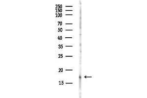anti-BTG Family, Member 2 (BTG2) antibody
