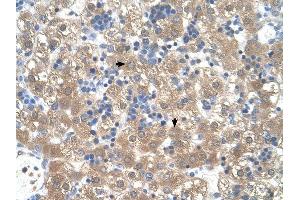 PEX3 antibody was used for immunohistochemistry at a concentration of 4-8 ug/ml to stain Hepatocytes (arrows) in Human Liver.