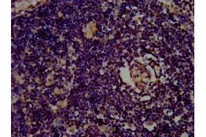 IHC image of ABIN7153444 diluted at 1:400 and staining in paraffin-embedded human lymph node tissue performed on a Leica BondTM system. (Galectin 10 anticorps  (AA 2-142))