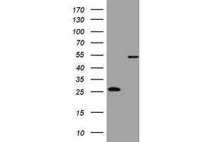 Image no. 4 for anti-3-Oxoacyl-ACP Synthase, Mitochondrial (OXSM) (AA 78-343) antibody (ABIN1491674) (OXSM anticorps  (AA 78-343))