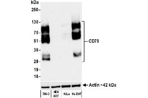 Western Blotting (WB) image for anti-CD70 Molecule (CD70) (AA 50-193) antibody (ABIN7449156) (Recombinant CD70 anticorps  (AA 50-193))