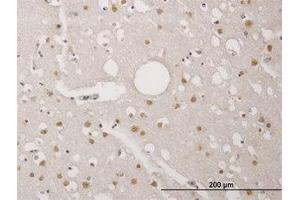 Image no. 1 for anti-TP53 Regulating Kinase (TP53RK) (AA 154-253) antibody (ABIN466264) (TP53RK anticorps  (AA 154-253))