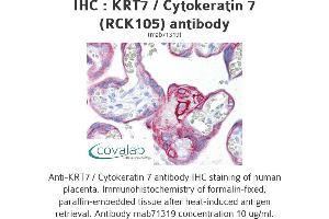 Image no. 1 for anti-Keratin 7 (KRT7) antibody (ABIN1724125) (Cytokeratin 7 anticorps)