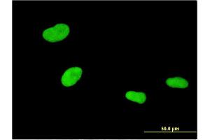 Immunofluorescence of monoclonal antibody to ZKSCAN4 on HeLa cell. (ZKSCAN4 anticorps  (AA 1-545))