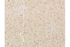 ABIN6265291 and ABIN6279800 at 1/100 staining rat brain tissue by IHC-P. (SRPK2 anticorps  (Internal Region))