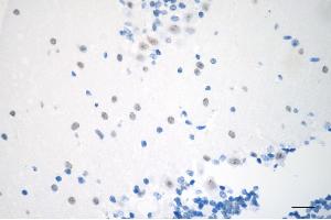 anti-Chromobox Homolog 3 (CBX3) antibody