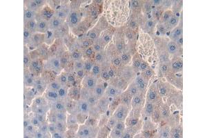 Used in DAB staining on fromalin fixed paraffin- embedded liver tissue