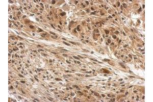 IHC-P Image Immunohistochemical analysis of paraffin-embedded U373 xenograft, using DDB1, antibody at 1:500 dilution.