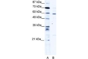 Human HepG2; WB Suggested Anti-PDLIM5 Antibody Titration: 1. (PDLIM5 anticorps  (Middle Region))