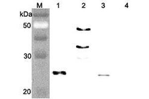 Western blot analysis of human FGF21 using anti-FGF-21 (human), pAb  at 1:4,000 dilution.